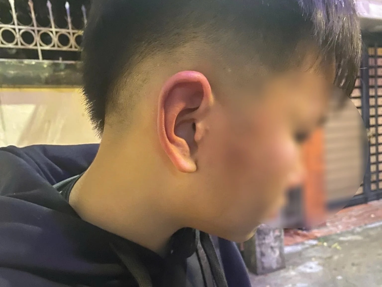 Hà Nội: Bé trai 12 tuổi bị bố bạn tát, sự việc gây chấn động xã hội - Ảnh 1. Hà Nội: Bé trai 12 tuổi bị bố bạn tát, sự việc gây chấn động xã hội - Ảnh 1.