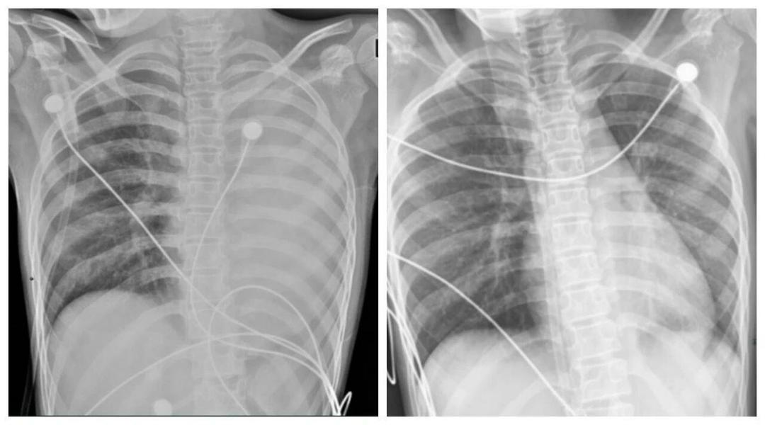 B&eacute; trai 12 tuổi 