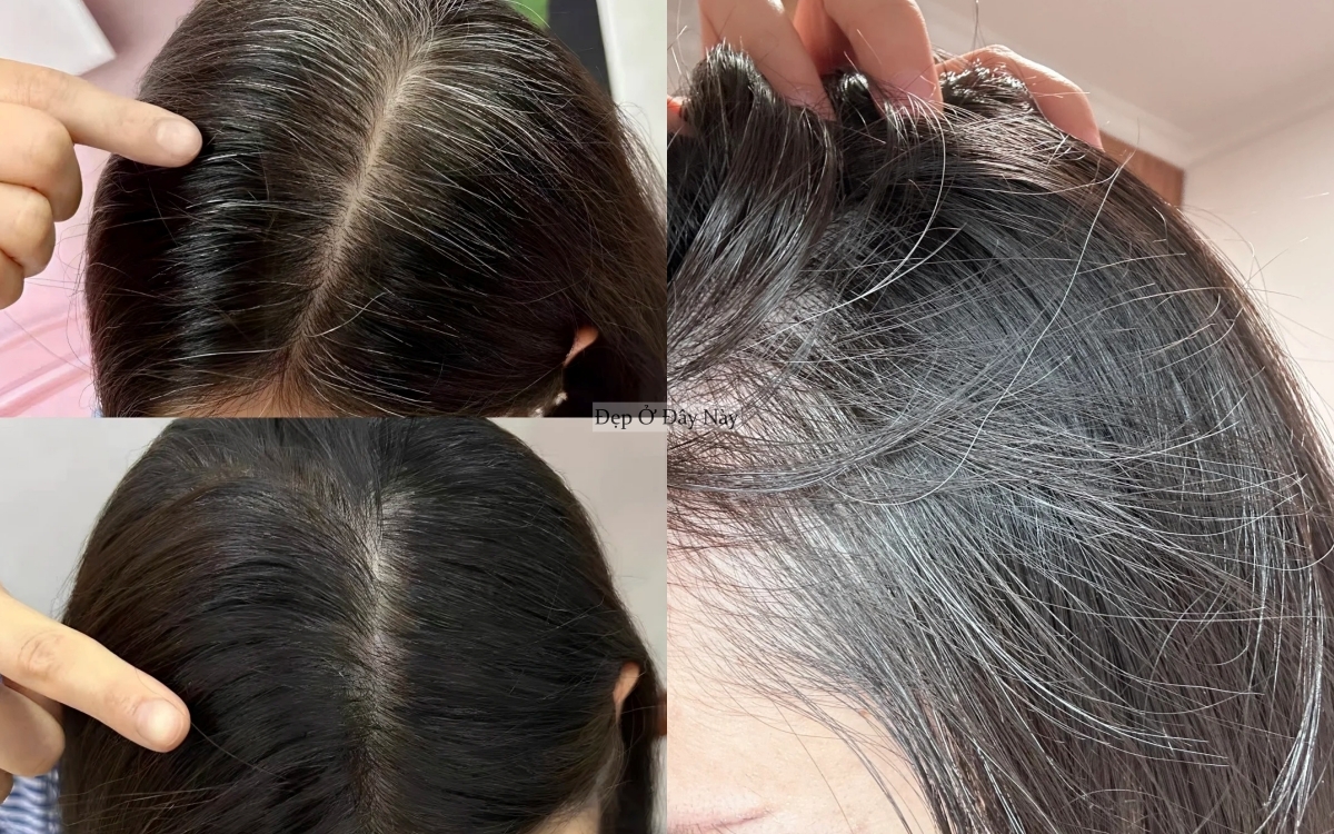 Vì sao phụ nữ trung niên không nên nhổ tóc bạc? - Ảnh 3.