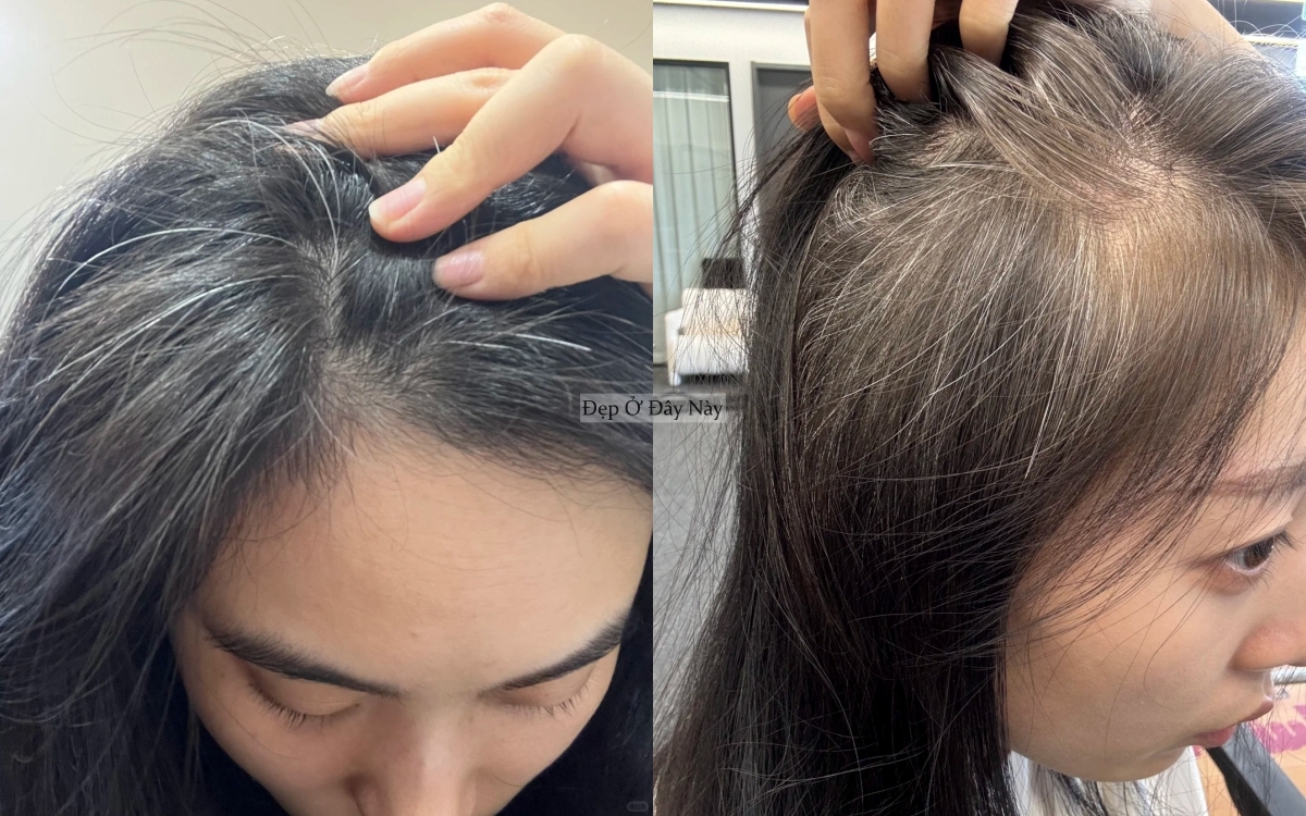 Vì sao phụ nữ trung niên không nên nhổ tóc bạc? - Ảnh 2.