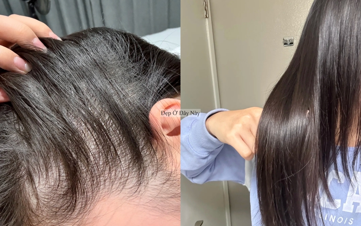 Học từ mẹ, tôi đã biết cách gội đầu sao cho tóc mọc tua tủa mà vẫn tiết kiệm tiền - Ảnh 5.