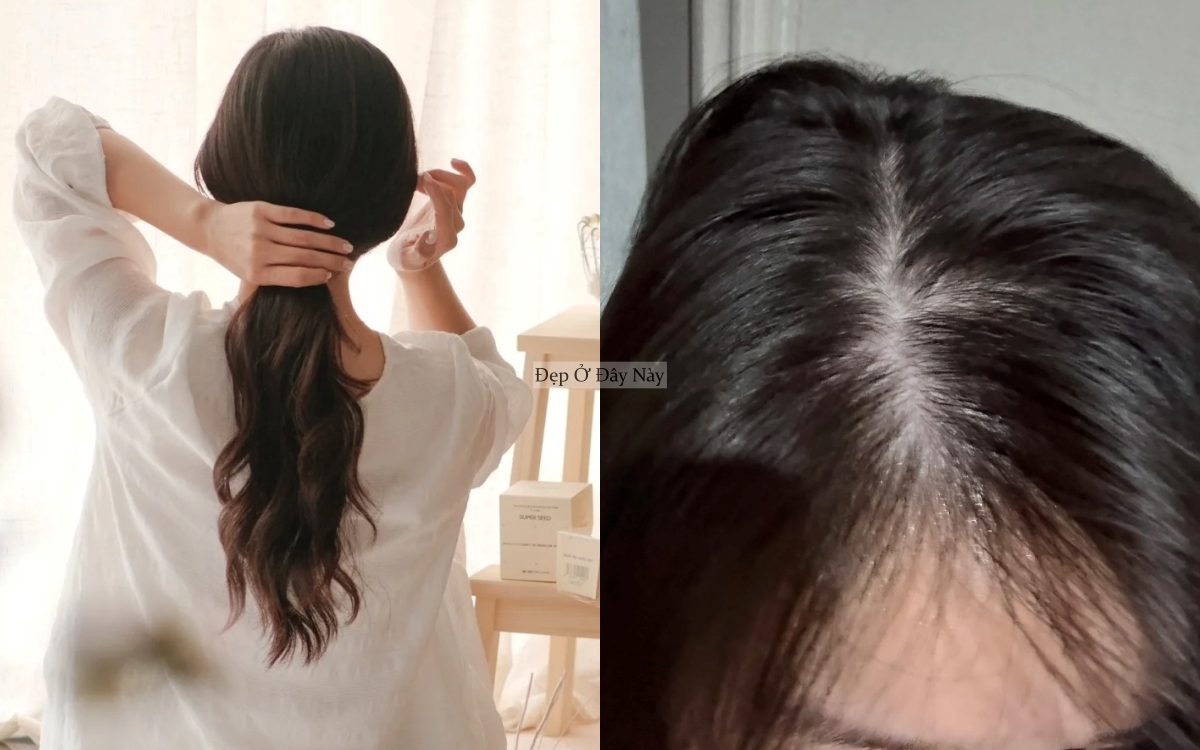 Học từ mẹ, tôi đã biết cách gội đầu sao cho tóc mọc tua tủa mà vẫn tiết kiệm tiền - Ảnh 6.