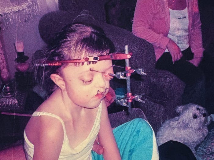 T&ocirc;i đ&atilde; che giấu khu&ocirc;n mặt suốt nhiều năm, nhưng giờ t&ocirc;i tự h&agrave;o chấp nhận vẻ kh&aacute;c biệt của ch&iacute;nh m&igrave;nh- Ảnh 3.