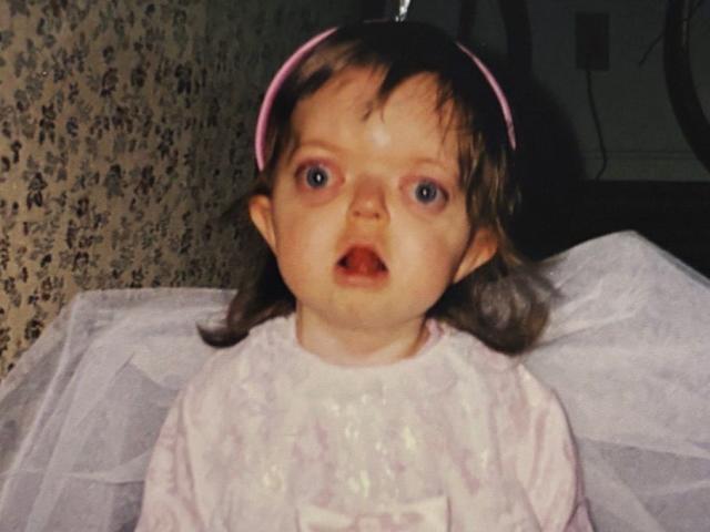 T&ocirc;i đ&atilde; che giấu khu&ocirc;n mặt suốt nhiều năm, nhưng giờ t&ocirc;i tự h&agrave;o chấp nhận vẻ kh&aacute;c biệt của ch&iacute;nh m&igrave;nh- Ảnh 2.