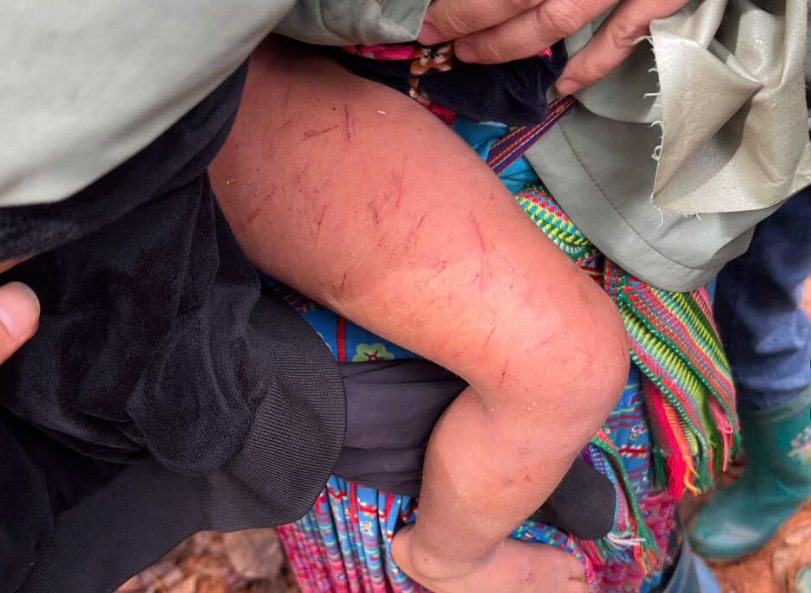 Lạc giữa rừng 15 giờ, bé trai 4 tuổi ở Lai Châu được tìm thấy an toàn - Ảnh 2. Lạc giữa rừng 15 giờ, bé trai 4 tuổi ở Lai Châu được tìm thấy an toàn - Ảnh 2.