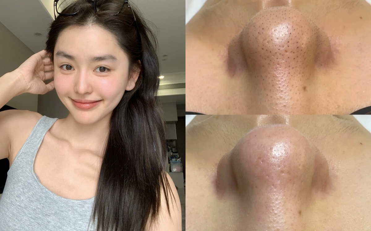 “Quét sạch” lỗ chân lông bít tắc với 5 loại mặt nạ đất sét làm sạch sâu chỉ sau 10 phút - Ảnh 1.