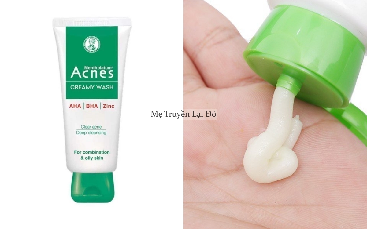 5 chai sữa rửa mặt