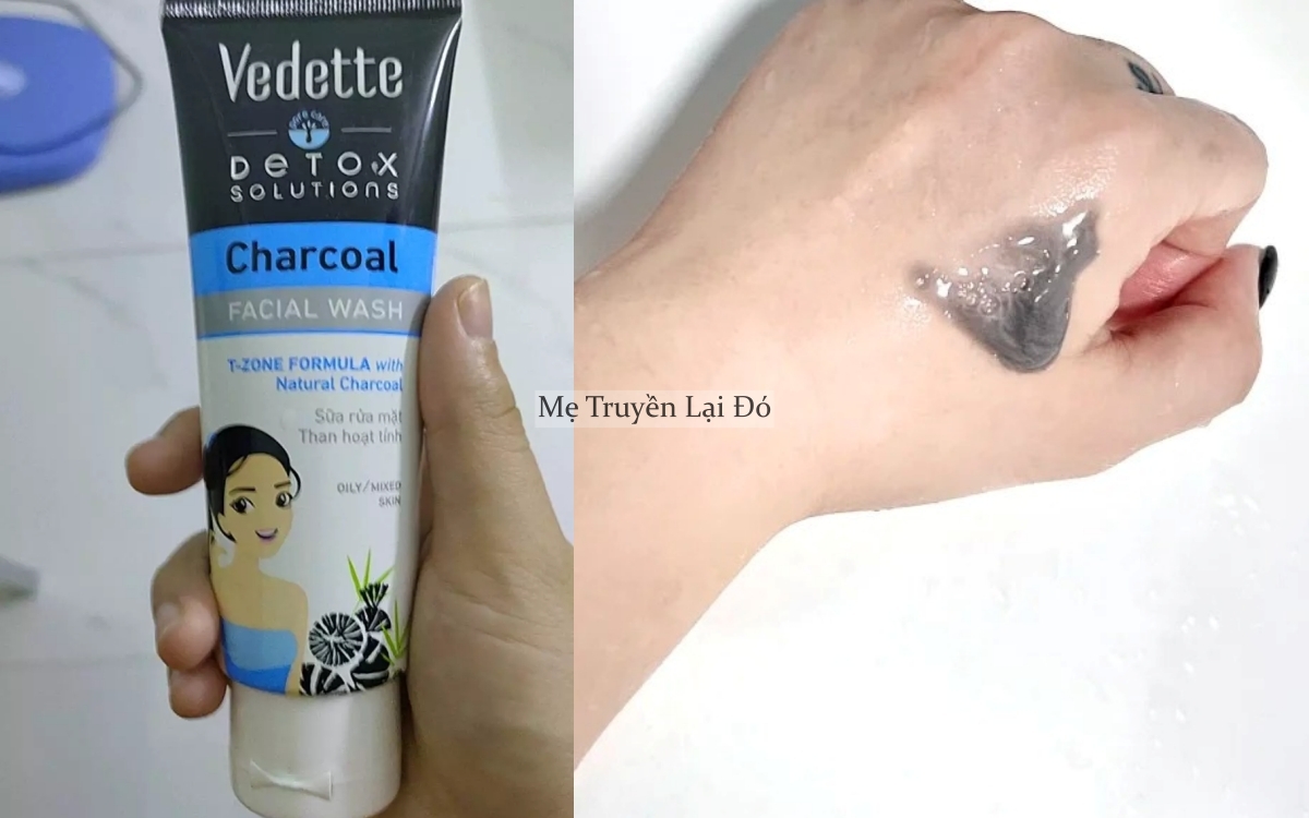 5 chai sữa rửa mặt