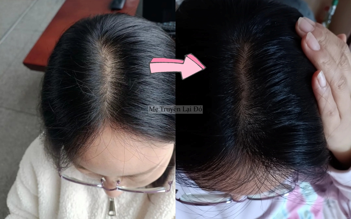 Bao năm mẹ t&ocirc;i d&ugrave;ng vỏ bưởi dưỡng t&oacute;c, t&ocirc;i đ&atilde; t&igrave;m được c&aacute;ch nhanh gọn v&agrave; tiện lợi hơn rất nhiều - Ảnh 3.