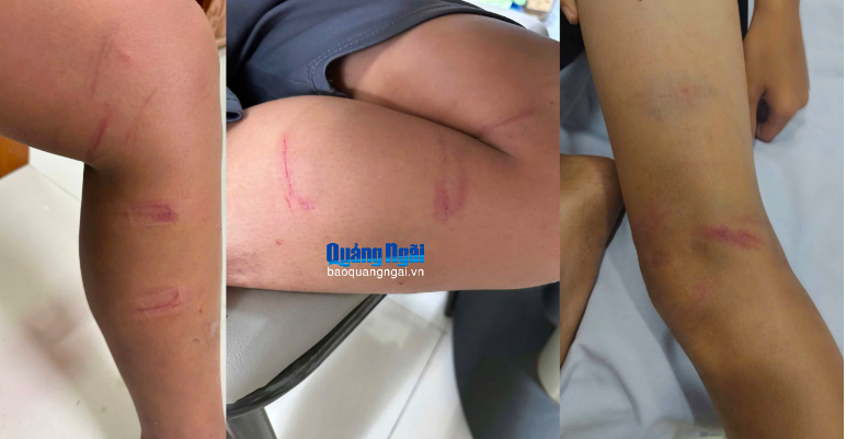 Danh t&iacute;nh người đ&agrave;n &ocirc;ng h&agrave;nh hung 3 b&eacute; trai tr&ecirc;n đường g&acirc;y phẫn nộ - Ảnh 1.