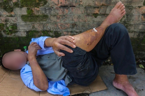 Người đ&agrave;n &ocirc;ng ở Huế bị nh&oacute;m học sinh đ&aacute;nh đập: Ho&agrave;n cảnh đ&aacute;ng thương, vẫn c&ograve;n sợ h&atilde;i - Ảnh 1.