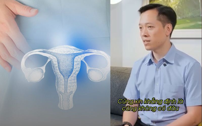 Kh&ocirc;ng đau đầu nhưng vẫn c&oacute; thể đột quỵ: 6 t&iacute;n hiệu &ldquo;im lặng&rdquo; của nhồi m&aacute;u n&atilde;o m&agrave; b&aacute;c sĩ cũng lo ngại - Ảnh 3.