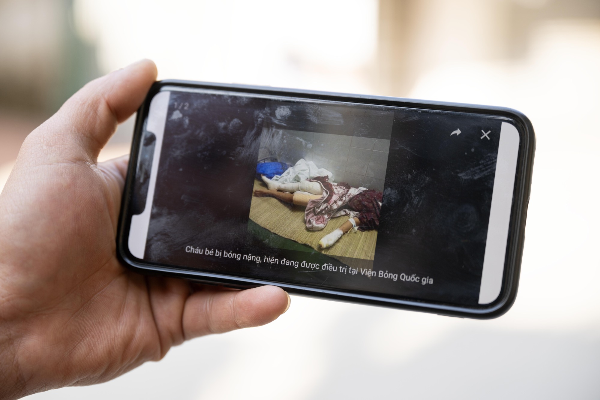 Vụ thả ch&oacute; dữ cắn người phụ nữ ở H&agrave; Nội: Nh&acirc;n chứng kể lại ph&uacute;t kinh ho&agrave;ng v&agrave; qu&aacute; khứ 