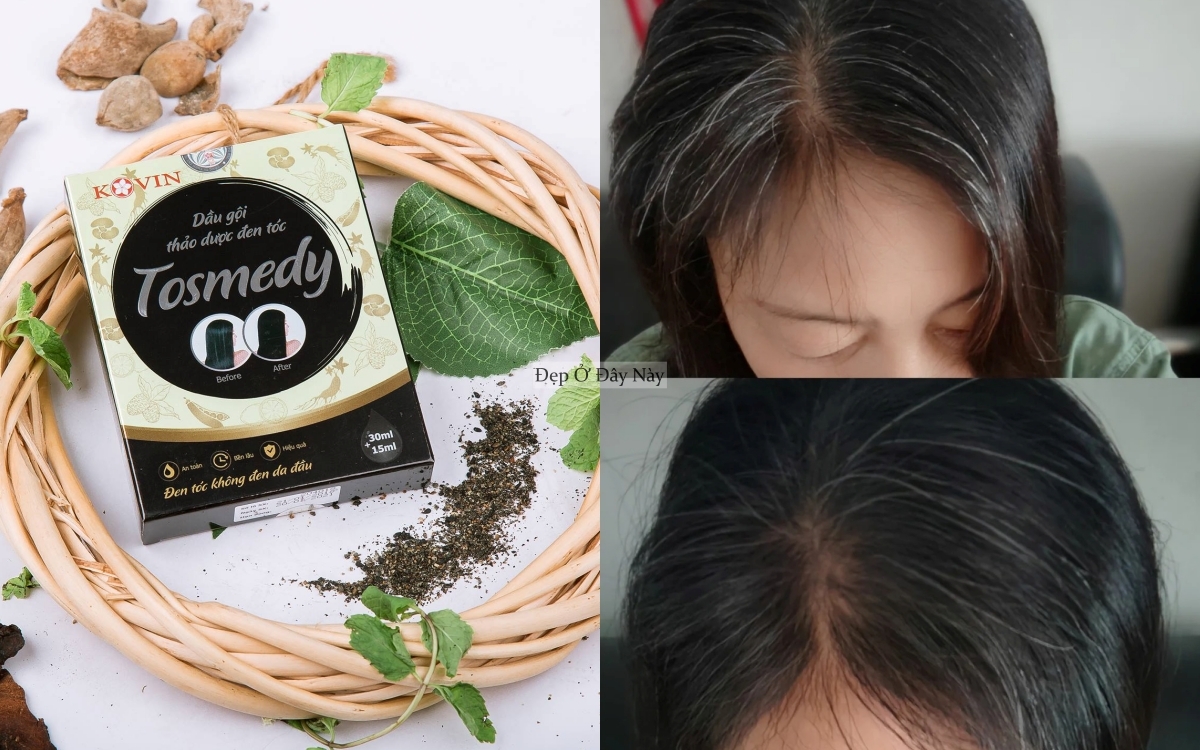 4 dầu gội phủ bạc thảo dược, kh&ocirc;ng chỉ nhuộm đen tại nh&agrave; m&agrave; c&ograve;n gi&uacute;p t&oacute;c khỏe hơn thấy r&otilde; - Ảnh 5.