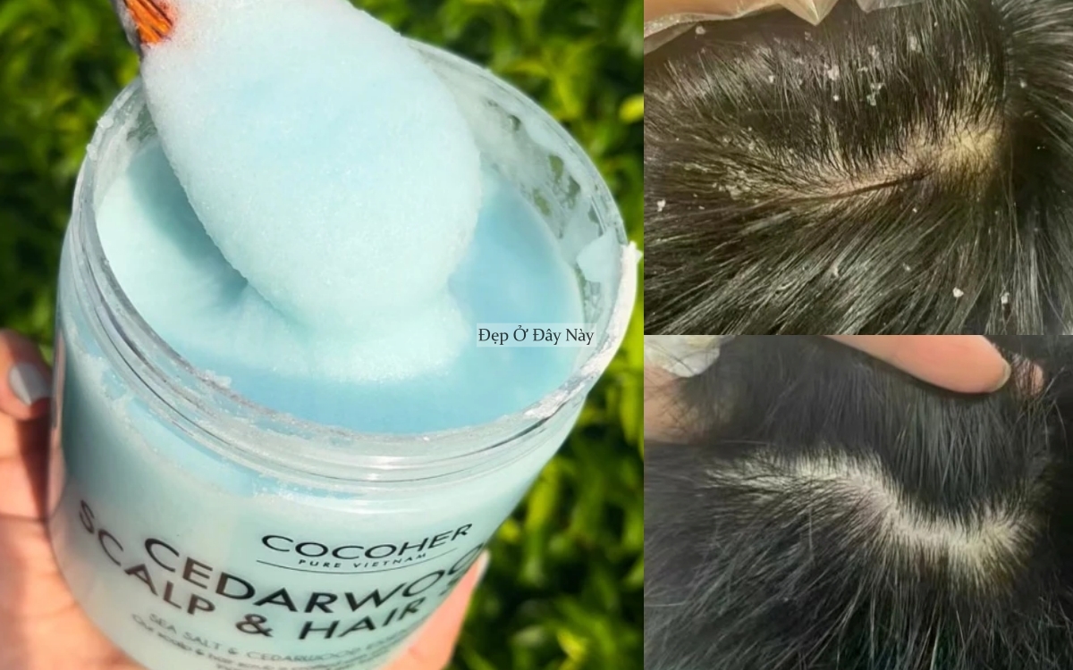 5 bước gội đầu đơn giản nhưng giúp tóc suôn mượt hơn hẳn trước Tết - Ảnh 2.