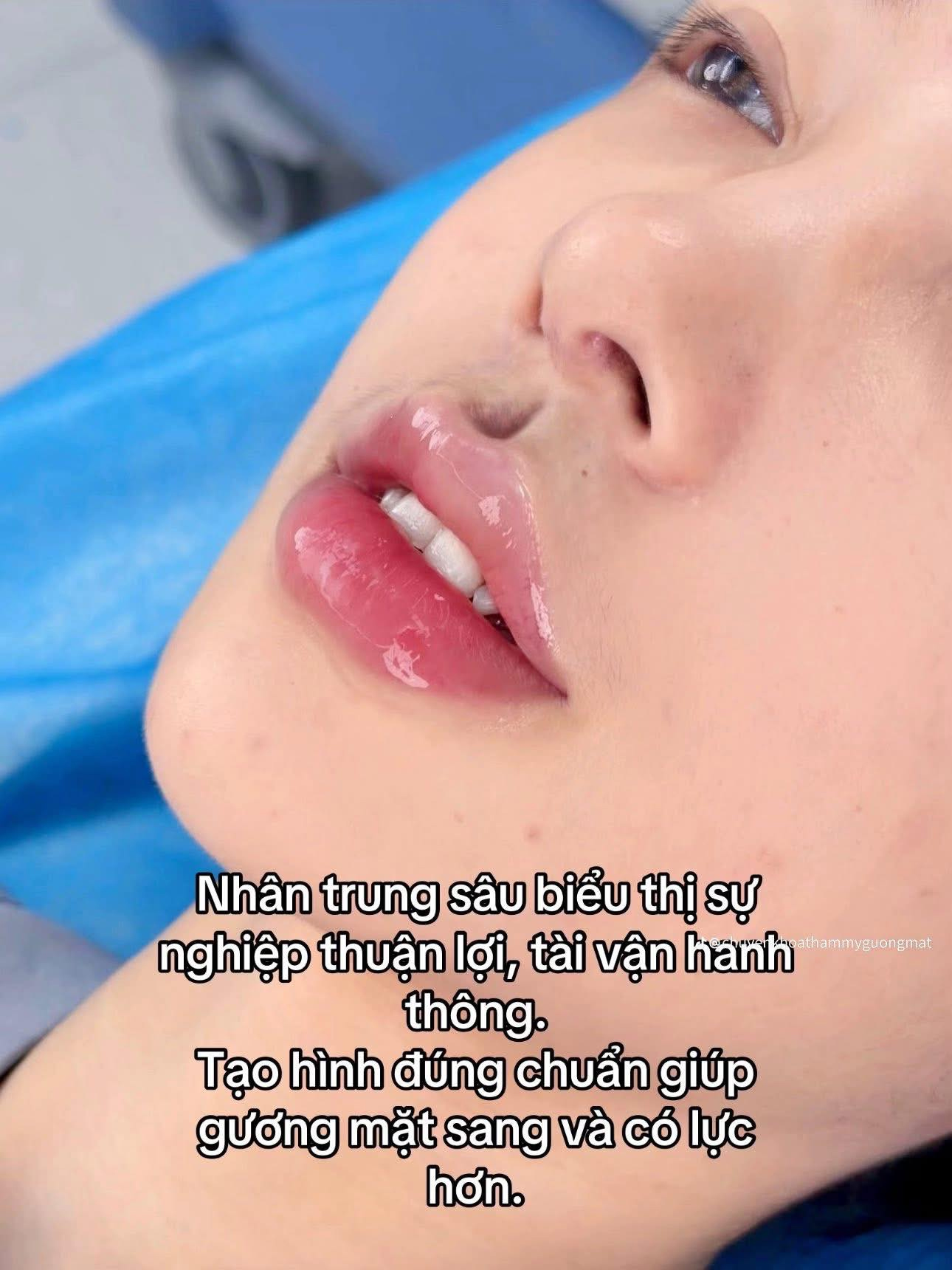 Nhân trung giọt nước chuẩn Trung Hoa khiến chị em phát sốt, người khen kẻ chê 