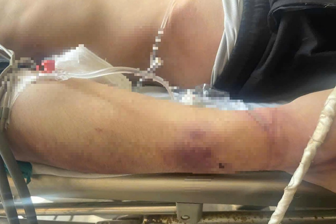 Chuyện đau l&ograve;ng về học vi&ecirc;n tử vong sau 2 ng&agrave;y tại Trung t&acirc;m C&ocirc;ng t&aacute;c x&atilde; hội Hải H&agrave; - Ảnh 1.