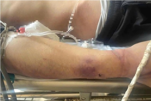 Thiếu niên tử vong tại trung tâm CTXH Hải Hà: Gia đình bức xúc tìm kiếm công lý - Ảnh 1. Thiếu niên tử vong tại trung tâm CTXH Hải Hà: Gia đình bức xúc tìm kiếm công lý - Ảnh 1.