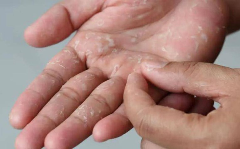 1 thói quen nấu nướng làm tăng nguy cơ mắc ung thư cho cả gia đình, đặc biệt là trẻ em - Ảnh 2.