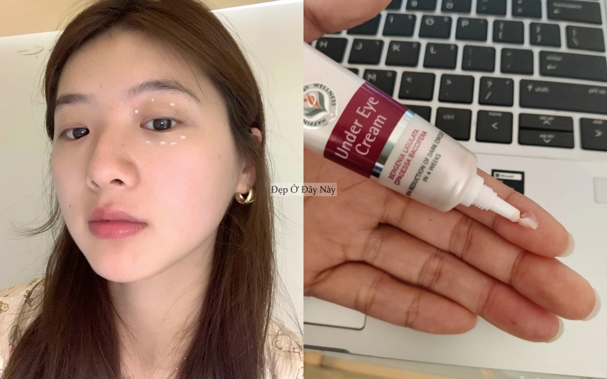 5 kem mắt bình dân giúp