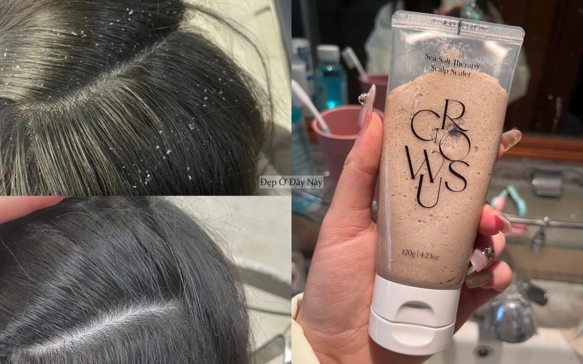 Muốn t&oacute;c mọc nhanh, khỏe v&agrave; d&agrave;y hơn th&igrave; nhất định phải sử dụng 5 sản phẩm n&agrave;y - Ảnh 2.