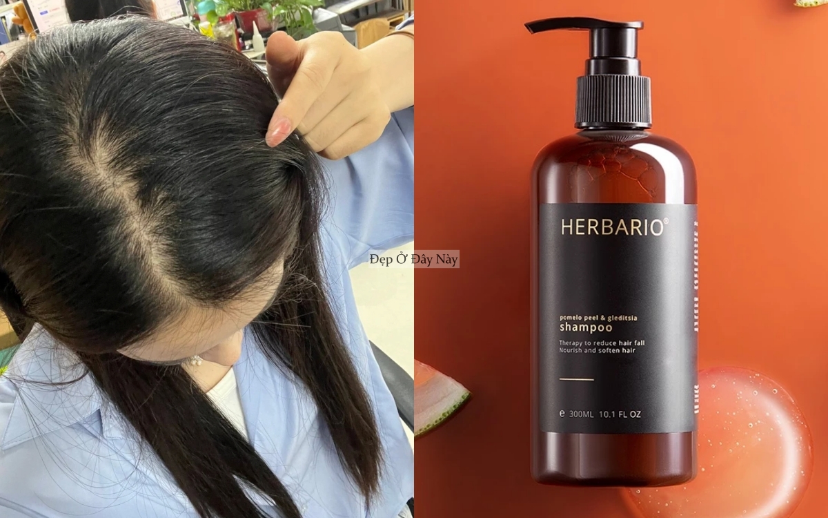 Muốn t&oacute;c mọc nhanh, khỏe v&agrave; d&agrave;y hơn th&igrave; nhất định phải sử dụng 5 sản phẩm n&agrave;y - Ảnh 3.