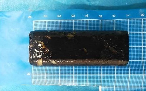 Bé 13 tháng tuổi ăn gì nôn đấy, bác sĩ gắp ra thứ 