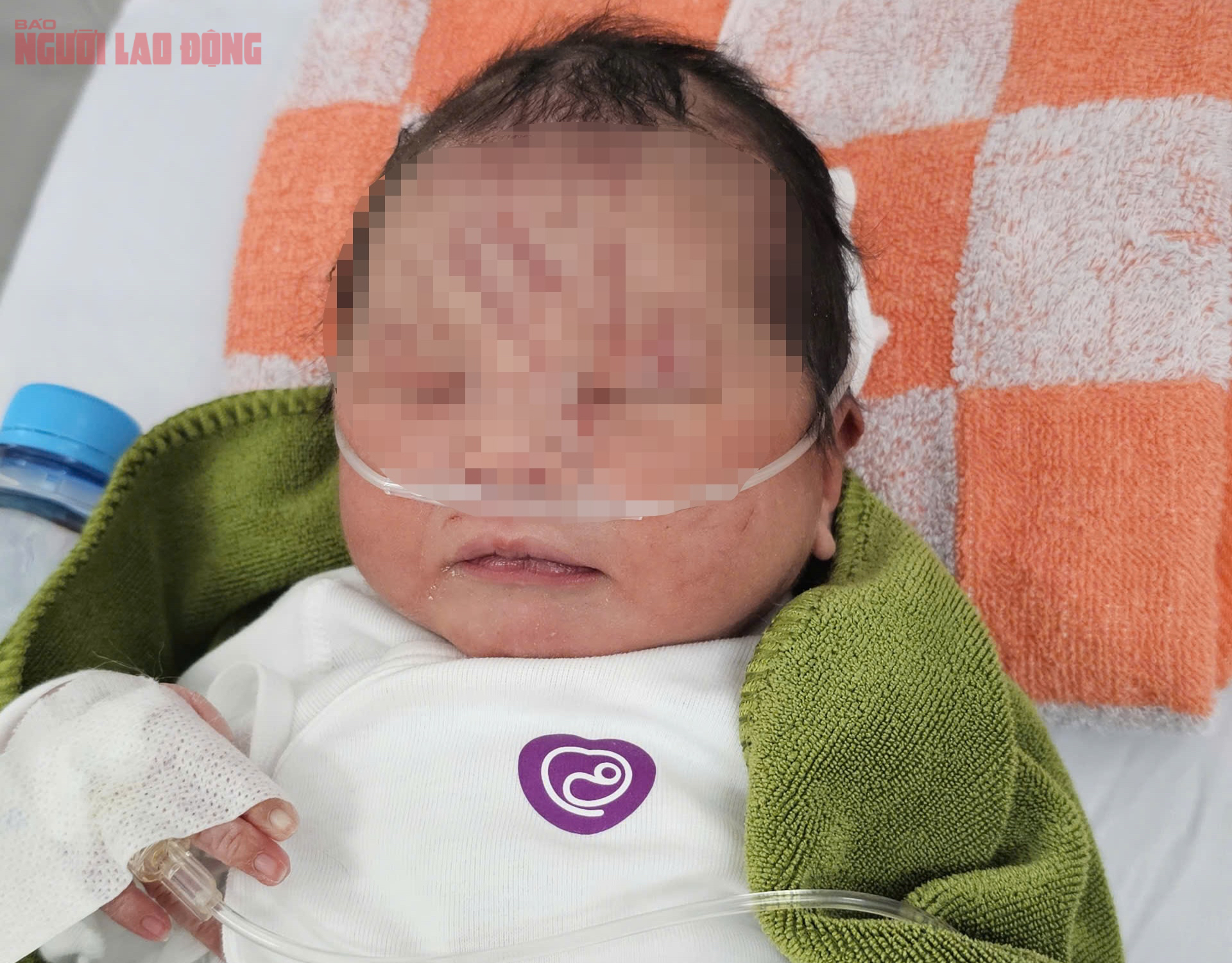 NÓNG: Một trẻ sơ sinh nghi bị NÓNG: Một trẻ sơ sinh nghi bị