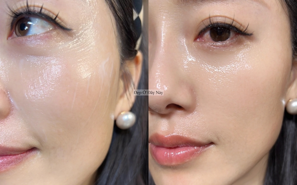 C&aacute;ch dưỡng da 