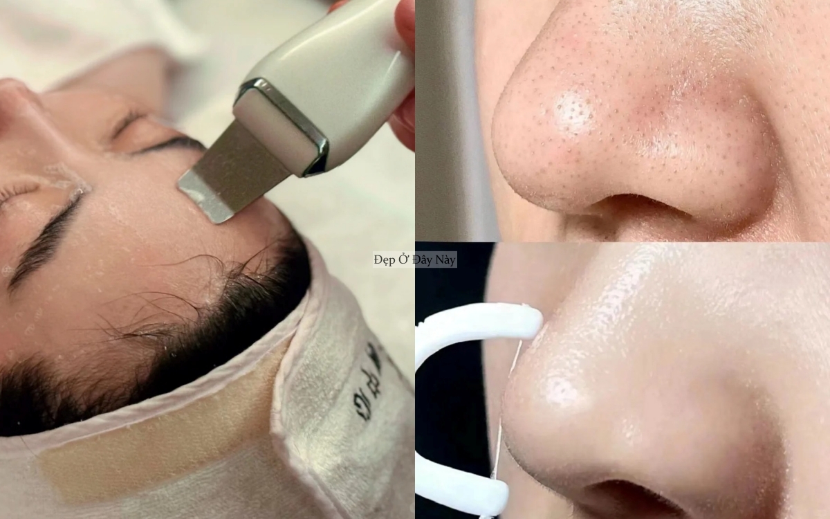 Dưỡng ngoài thôi là chưa đủ, phụ nữ Hàn có 4 loại máy này để da đẹp tận lỗ chân lông - Ảnh 5.