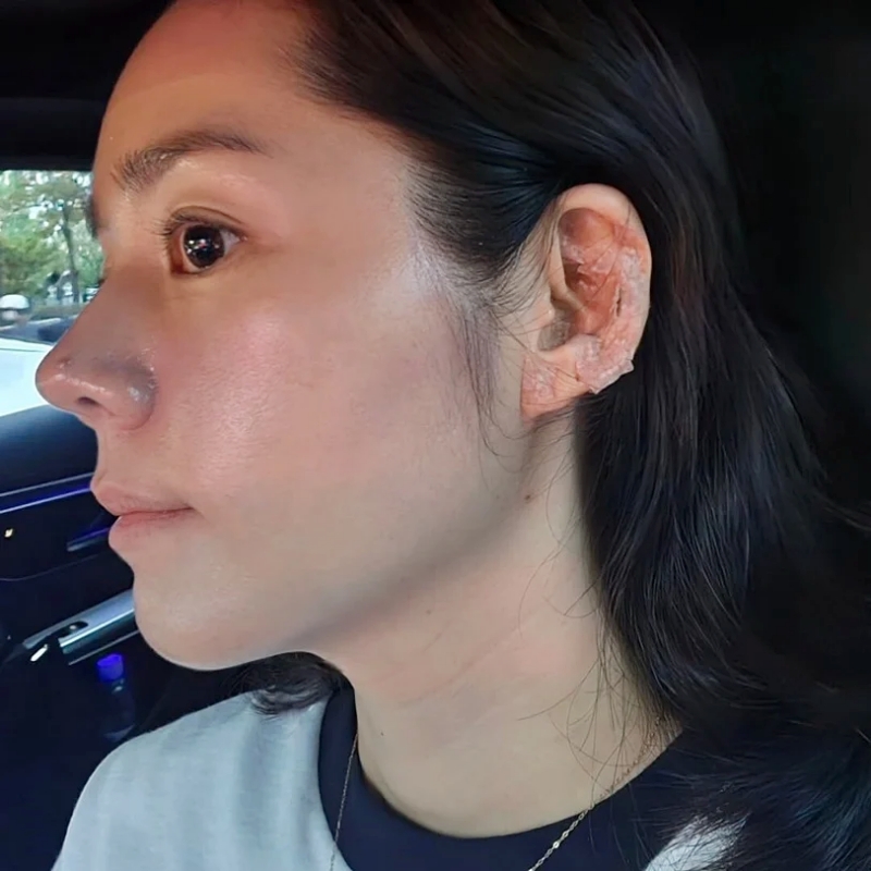 "Mỹ nhân mặt mộc đẹp nhất Hàn Quốc" lộ ảnh góc mũi đẹp rụng rời, từng tự nhận da xấu nhưng không ai tin  - Ảnh 3.