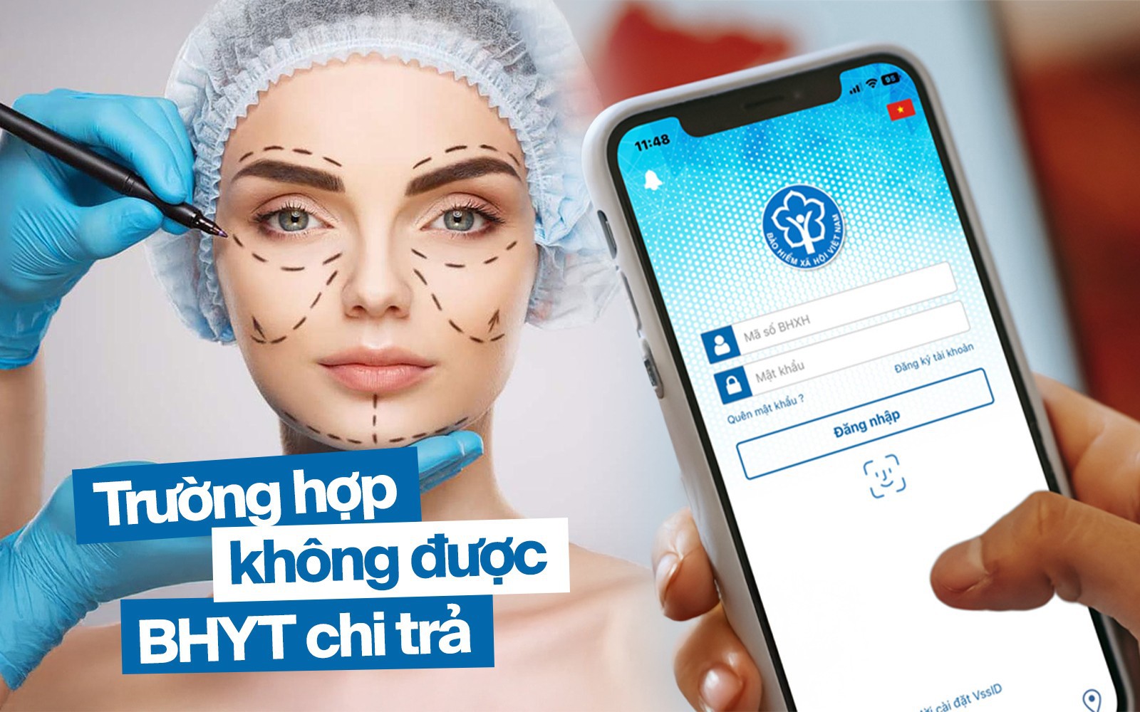 &quot;Cứ nghĩ có bảo hiểm y tế, tôi đến viện mới biết mình không được chi trả&quot;: 12 trường hợp BHYT có giá trị sử dụng nhưng không được thanh toán