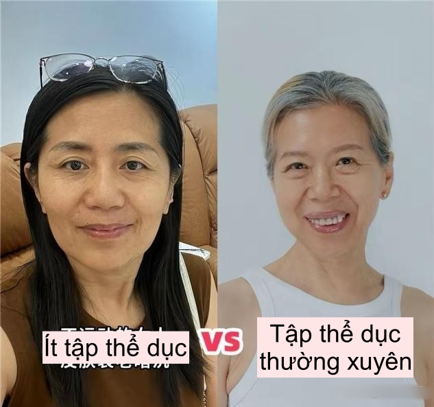 “Da chảy xệ” tố cáo tuổi tác rõ ràng đến mức nào? Xem xong so sánh tôi mới hiểu: Càng lớn tuổi càng phải tập thể dục! - Ảnh 6.