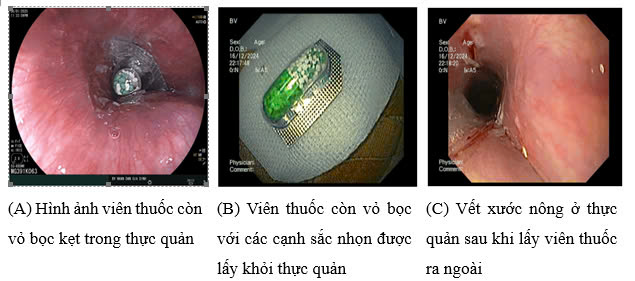 Nhiều người nhập viện vì uống thuốc còn nguyên vỏ- Ảnh 1.