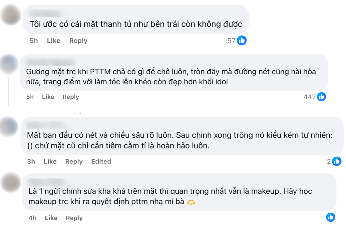 Bức ảnh trước và sau khi PTTM của cô gái bí ẩn khiến hàng ngàn người tiếc nuối nhất- Ảnh 3.