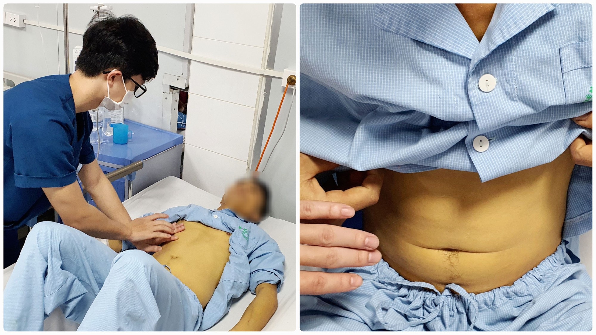 Cảnh báo: Suy gan, thận do ngộ độc nấm - Ảnh 1. Cảnh báo: Suy gan, thận do ngộ độc nấm - Ảnh 1.
