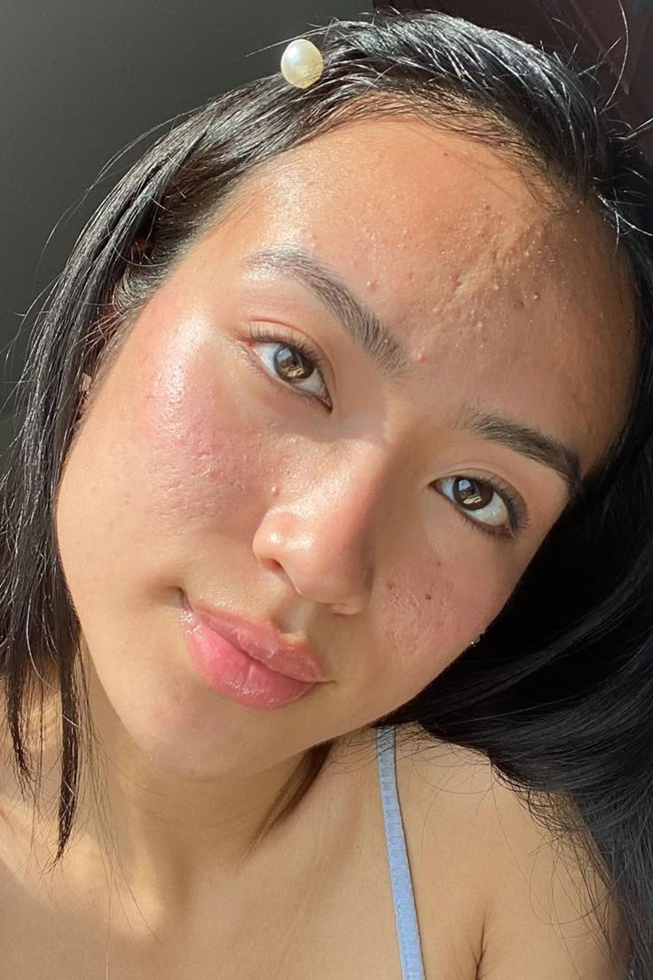 Để việc skincare không trở thành thảm họa, bạn cần biết chính xác mình thuộc loại da nào! - Ảnh 7. Để việc skincare không trở thành thảm họa, bạn cần biết chính xác mình thuộc loại da nào! - Ảnh 7.