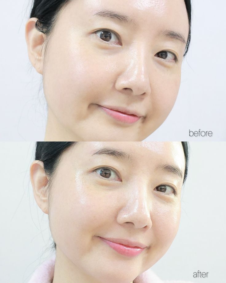 Để việc skincare không trở thành thảm họa, bạn cần biết chính xác mình thuộc loại da nào! - Ảnh 4. Để việc skincare không trở thành thảm họa, bạn cần biết chính xác mình thuộc loại da nào! - Ảnh 4.