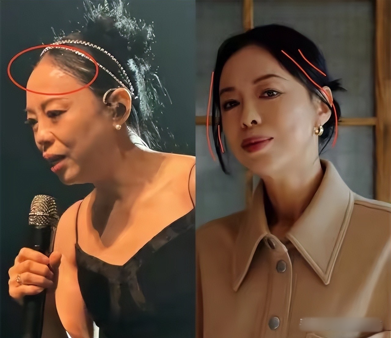 Cứ nghĩ trung niên thì để tóc mái để nhìn trẻ hơn, ai dè đó lại là sai lầm chí mạng của tôi! - Ảnh 9. Cứ nghĩ trung niên thì để tóc mái để nhìn trẻ hơn, ai dè đó lại là sai lầm chí mạng của tôi! - Ảnh 9.