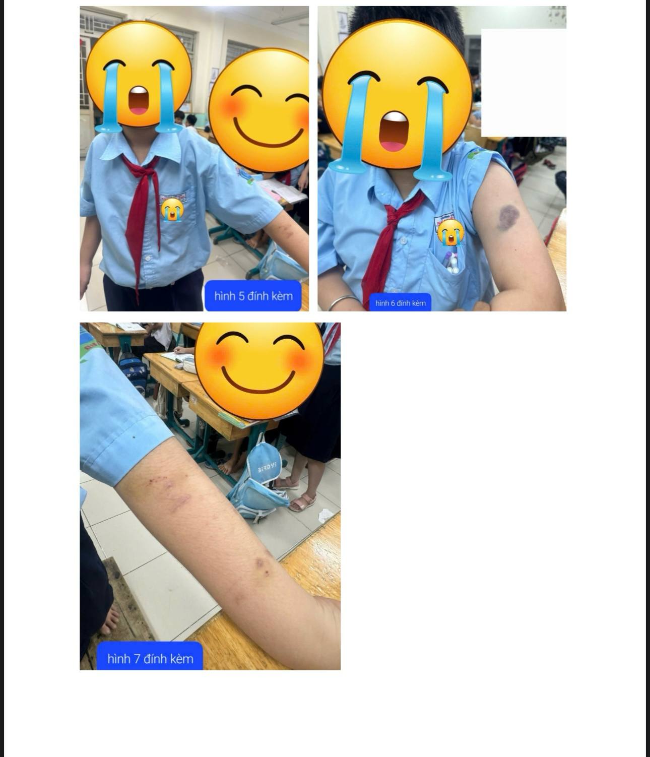 TP HCM: Gi&aacute;o vi&ecirc;n chủ nhiệm bị tố nhiều lần đ&aacute;nh học sinh - Ảnh 1.