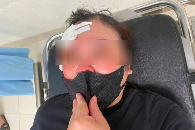 Người trên ô tô bán tải bị tố vụt dùi cui vào đầu nữ tài xế nói gì về nguyên nhân?- Ảnh 1. Người trên ô tô bán tải bị tố vụt dùi cui vào đầu nữ tài xế nói gì về nguyên nhân?- Ảnh 1.