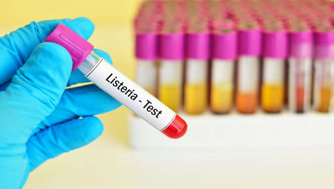 Mỹ ghi nhận đợt bùng phát vi khuẩn Listeria liên quan đến thực phẩm chế biến sẵn - Ảnh 1. Mỹ ghi nhận đợt bùng phát vi khuẩn Listeria liên quan đến thực phẩm chế biến sẵn - Ảnh 1.