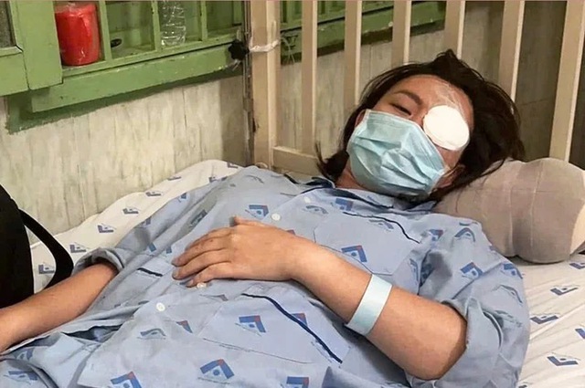 Cô gái bị người yêu cũ đánh gục trong quán cà phê, tổn thương 23% cơ thể: Yêu cầu bồi thường 900 triệu đồng - Ảnh 2. Cô gái bị người yêu cũ đánh gục trong quán cà phê, tổn thương 23% cơ thể: Yêu cầu bồi thường 900 triệu đồng - Ảnh 2.