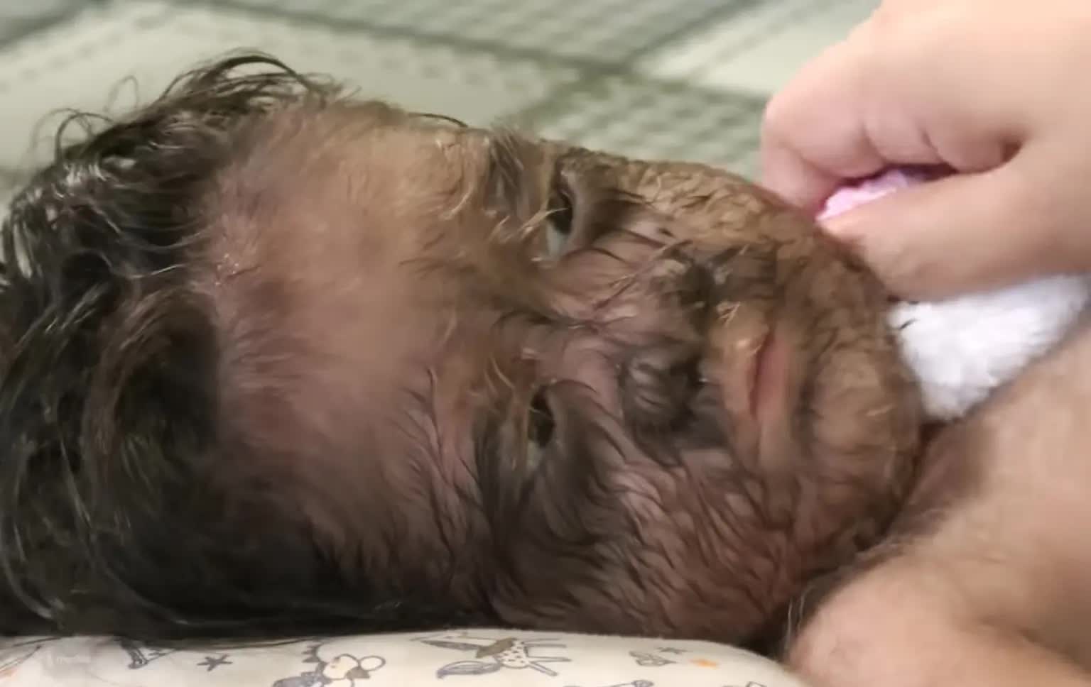 Vì sao bé gái "người sói" đầy lông lá này được gọi là "đứa trẻ đến từ thiên đường"? - Ảnh 1. Vì sao bé gái "người sói" đầy lông lá này được gọi là "đứa trẻ đến từ thiên đường"? - Ảnh 1.