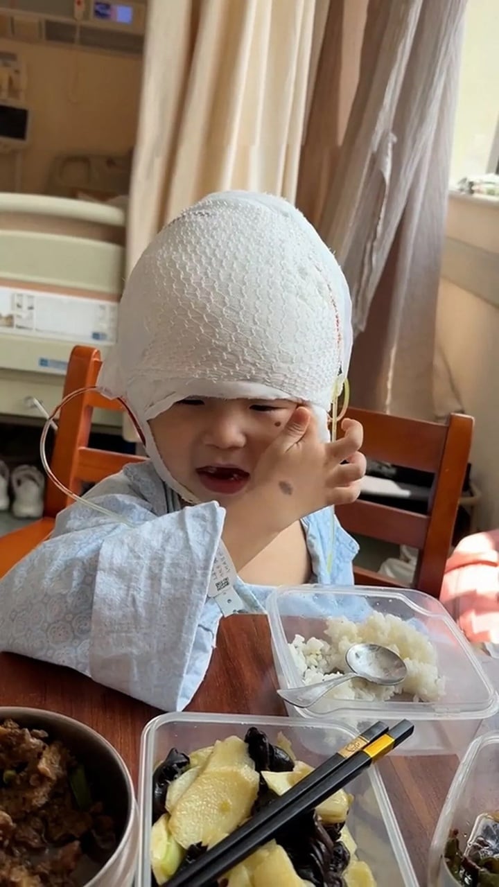 Nốt ruồi khổng lồ phủ kín hộp sọ khiến cậu bé có ngoại hình giống chuột Mickey - Ảnh 4. Nốt ruồi khổng lồ phủ kín hộp sọ khiến cậu bé có ngoại hình giống chuột Mickey - Ảnh 4.