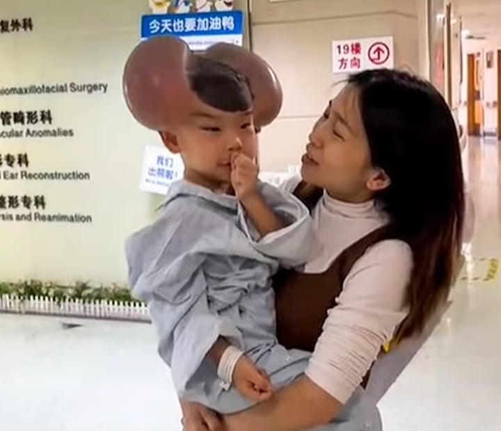 Nốt ruồi khổng lồ phủ kín hộp sọ khiến cậu bé có ngoại hình giống chuột Mickey - Ảnh 3. Nốt ruồi khổng lồ phủ kín hộp sọ khiến cậu bé có ngoại hình giống chuột Mickey - Ảnh 3.