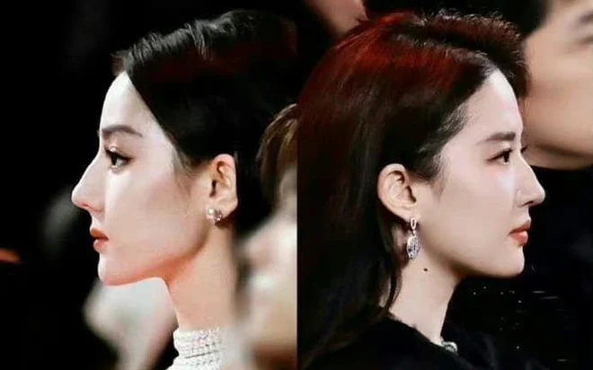 Những chiếc mũi khiến visual thăng hoa của dàn mỹ nhân Hoa ngữ, 1 nhân vật gây tranh cãi- Ảnh 4. Những chiếc mũi khiến visual thăng hoa của dàn mỹ nhân Hoa ngữ, 1 nhân vật gây tranh cãi- Ảnh 4.