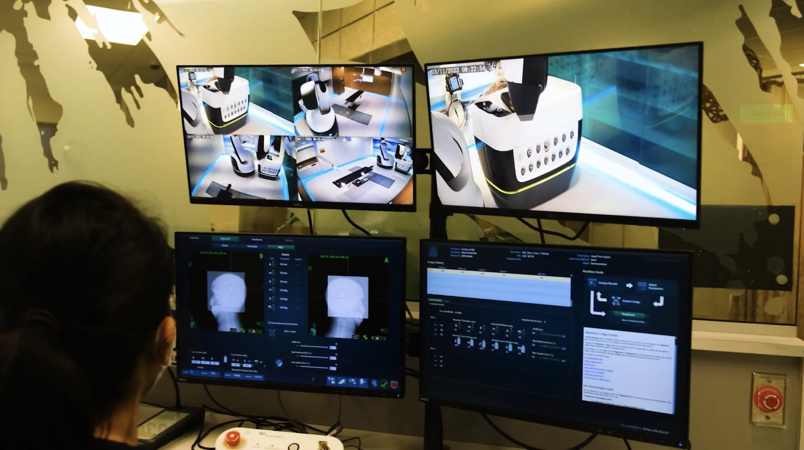 Xạ phẫu bằng robot tích hợp AI: Bước đột phá trong điều trị ung thư không xâm lấn- Ảnh 1. Xạ phẫu bằng robot tích hợp AI: Bước đột phá trong điều trị ung thư không xâm lấn- Ảnh 1.