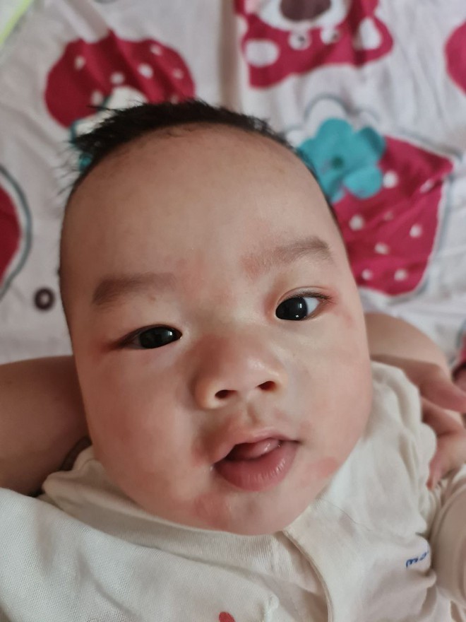Vật lộn chọn sữa cho con bị dị ứng đạm sữa bò trong điều kiện kinh tế không quá xuất sắc, mẹ bỉm chia sẻ kinh nghiệm để có được 1 em bé 19 tháng nặng 17kg- Ảnh 3. Vật lộn chọn sữa cho con bị dị ứng đạm sữa bò trong điều kiện kinh tế không quá xuất sắc, mẹ bỉm chia sẻ kinh nghiệm để có được 1 em bé 19 tháng nặng 17kg- Ảnh 3.