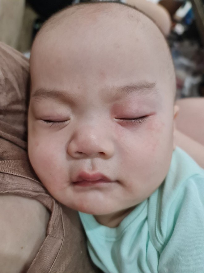 Vật lộn chọn sữa cho con bị dị ứng đạm sữa bò trong điều kiện kinh tế không quá xuất sắc, mẹ bỉm chia sẻ kinh nghiệm để có được 1 em bé 19 tháng nặng 17kg- Ảnh 5. Vật lộn chọn sữa cho con bị dị ứng đạm sữa bò trong điều kiện kinh tế không quá xuất sắc, mẹ bỉm chia sẻ kinh nghiệm để có được 1 em bé 19 tháng nặng 17kg- Ảnh 5.